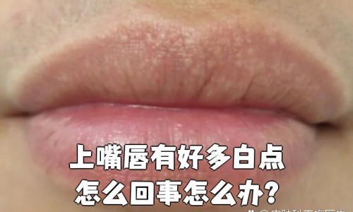 坐月期间可以吃虾吗网 - 网站提供月子期可以吃虾吗小常识、坐月子可不可吃虾